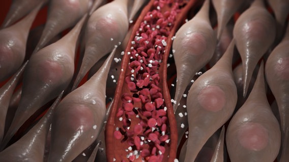 Schematische Darstellung: Blutgefäß, aus dem Zuckermoleküle in die umliegenden Muskelzellen strömen. © NDR 