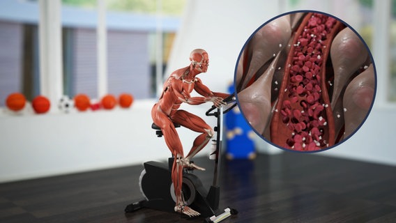 Schematische Darstellung: Muskelmann auf dem Trainingsrad, Zoom: Muskeln, die Zucker aus dem Blut aufnehmen. © NDR 