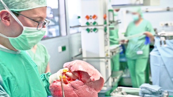 Arzt im OP hält eine Lunge in der Hand. © NDR 