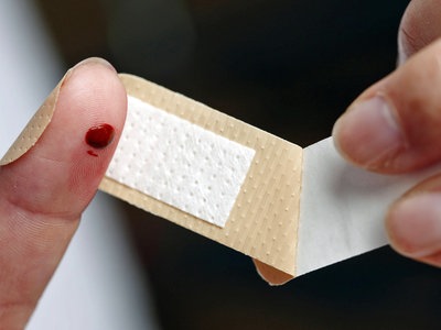 Welches Pflaster Fur Welche Wunde Ndr De Ratgeber Gesundheit