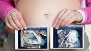 Ein schwangere Frau hält im Perinatalzentrum der Asklepios Klinik Altona in Hamburg nach ihrer 3D-Ultraschall-Untersuchung 3D-Bilder von ihrem Baby neben ihren Bauch. © dpa Themendienst Foto: Bodo Marks