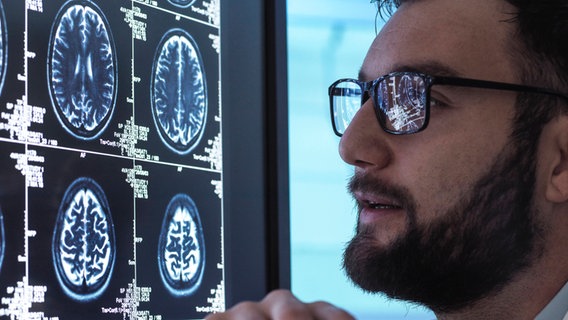 Schädel-Hirn-Trauma: Arzt betrachtet MRT eines Gehirns © imago images / Westend61 