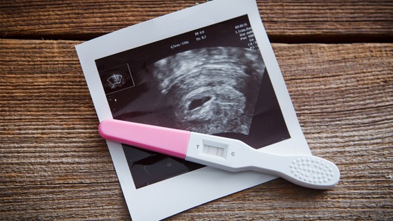 Schwangerschaftstest und ein Ultraschallbild liegen auf einem Holztisch. © Ramona Heim Foto: Ramona Heim