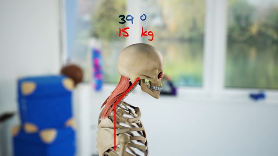 Schematische Darstellung: Bei 39 Grad vorgebeugtem Kopf ziehen 15 Kilo an den Nackenmuskeln. © NDR 