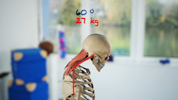 Schematische Darstellung: Bei 60 Grad vorgebeugtem Kopf ziehen 27 Kilo an den Nackenmuskeln. © NDR 