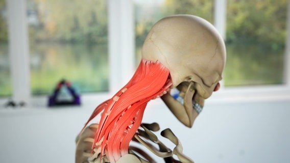 Schematische Darstellung: rot glühende Nackenmuskulatur an einem menschlichen Skelett. © NDR 