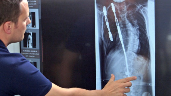 B-Doc Christian Sturm betrachtet ein Röntgenbild der Wirbelsäule. © NDR 