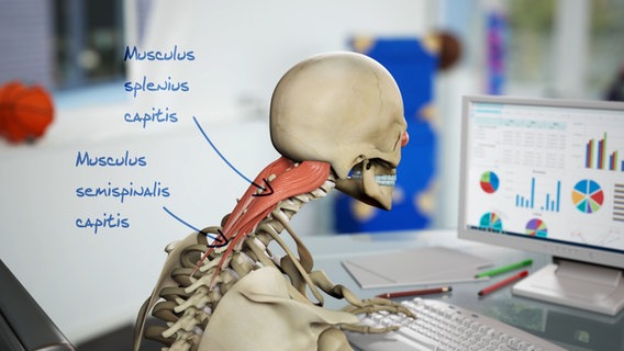 Schematische Darstellung: sitzendes, vorgebeugtes Skelett, Muskelstränge im Nacken. © NDR 