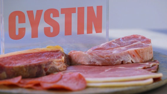 Ein Platte mit Fleisch und Aufschnitt neben dem Schild "Zystin". © NDR 