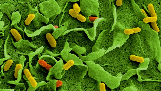 Elektronenmikroskopische Aufnahme von Listerien (Listeria monocytogenes) auf der Oberfläche einer Zelle. © Picture Alliance/Manfred Rohde/Helmholtz-Zentrum für Infektionsforschung/dpa Foto: Manfred Rohde