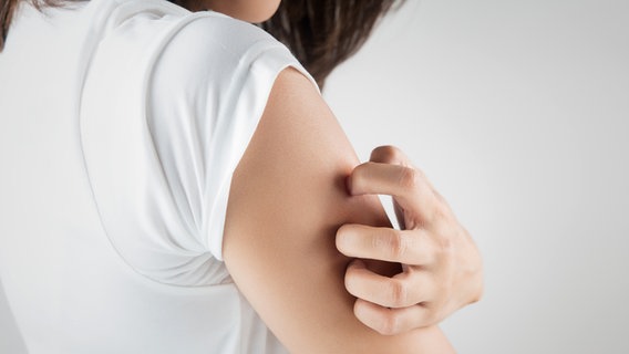 Eine junge Frau mit einem T-Shirt kratzt sich am Oberarm. © fotolia.com Foto: Adiano