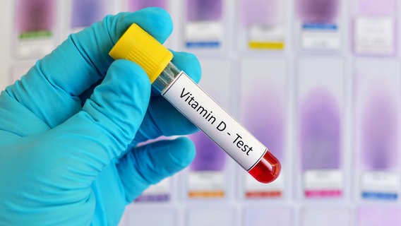 Ampulle mit Blutprobe für Vitamin-D-Test © fotolia.com Foto: arun011