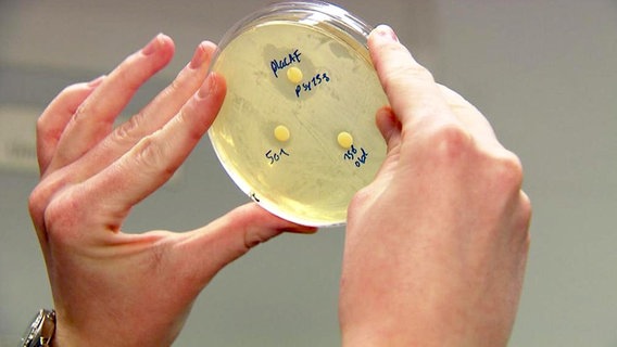 Bakterienkulturen in einer Petrischale.  
