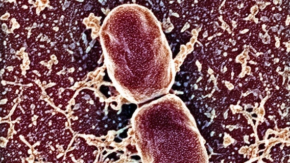 Cholera-Erreger unter dem Mikroskop © picture-alliance / OKAPIA KG, Ge Foto: Dr.Gary Gaugler/OKAPIA