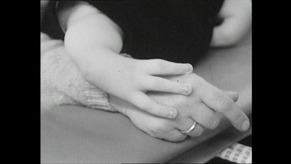 Eine Kinderhand mit Fehlbildungen liegt auf der Hand eines Erwachsenen (Archivbild)  