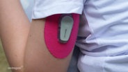Ein Kind hat wegen Diabetes einen Sensor am Arm. © Screenshot 