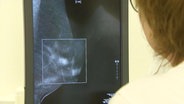 Blick über die Schulter einer Ärztin auf einen Bildschirm der eine Mammografie-Aufnahme zeigt. © Screenshot 