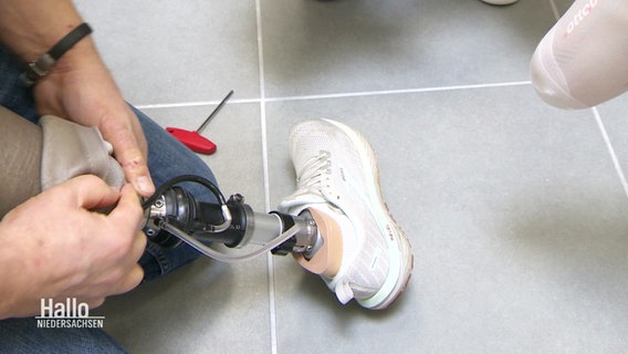 Eine Beinprothese wird angepasst. © Screenshot 