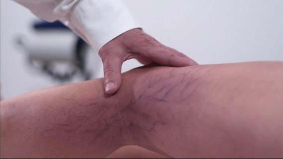 Ein Arzt untersucht das Bein einer Frau. © Screenshot 