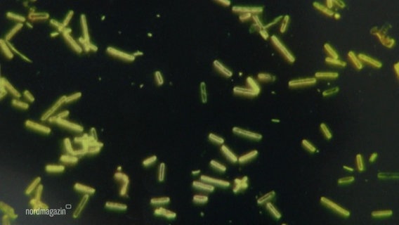 Eine Mikroskopaufnahme von Vibrionen  