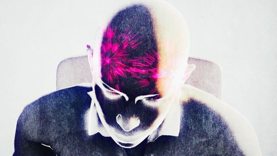 Illustration von Spannungskopfschmerz: Zeichnung eines Menschen ohne Haare. Blick auf den Kopfs von schräg oben. Zwei Punkte, die zu explodieren scheinen, markieren Schmerzpunkte im Stirnbereich. © NDR 