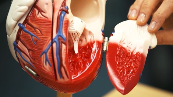 Modell eines Herzens mit Herzklappe. © NDR 