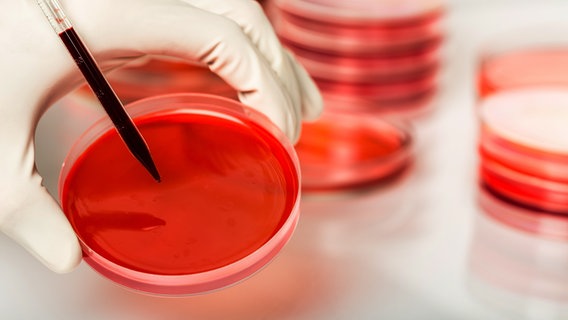Eine Blutprobe in einer Petrischale im Labor © panthermedia Foto: billiondigital