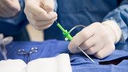 Chirurg operiert mit Hilfe eines Katheders © colourbox Foto: -