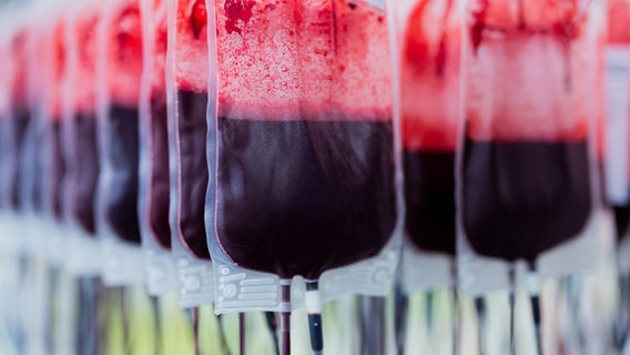 Blutkonserven werden in einem Labor für Krankenhäuser und Praxen gefiltert und aufbereitet. © dpa Foto: Rolf Vennenbernd
