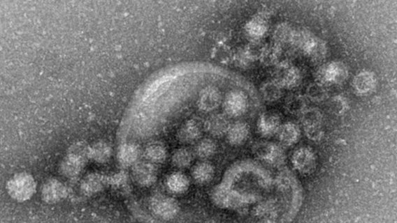 Elektronenmikroskopische Aufnahme des Norovirus © dpa/Robert-Koch-Institut Foto: Gudrun Holland