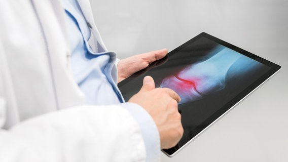 Ein Arzt sieht sich das Röntgenbild eines Gelenks auf einem Tablet an. © picture alliance / Zoonar | DAVID HERRAEZ CALZADA Foto: DAVID HERRAEZ CALZADA
