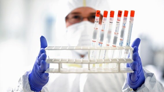 Ein Labor-Mitarbeiter hält einen Ständer mit diversen Rachenabstrichröhrchen in den Händen. © dpa Foto: Felix Kästle