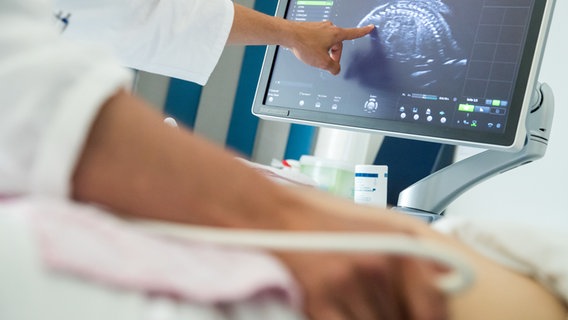 Ein Ultraschall-Untersuchung während der Schwangerschaft. © dpa picture alliance Foto: Daniel Karmann