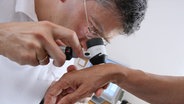 Dermatologe untersucht mit einer Lupe die Haut eines Patienten. © picture alliance dpa Foto: Bernd Wüstneck/dpa