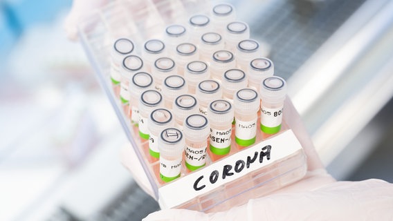 Eine biologisch-technische Assistentin zeigt aufbereitete PCR-Tests auf das Corona-Virus von Patienten im PCR-Labor vom Niedersächsischen Landesgesundheitsamt (NLGA). © picture alliance/dpa Foto: Julian Stratenschulte