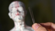 Akupunkturnadeln werden vor den Kopf eines Akupunkturmodells gehalten. © Picture Alliance Foto: Foto: Jens Kalaene/dpa