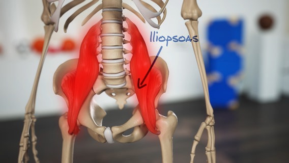 Schematische Darstellung: Beckenskelett mit Hüftbeuger-Muskeln, beschriftet Iliopsoas. © NDR 