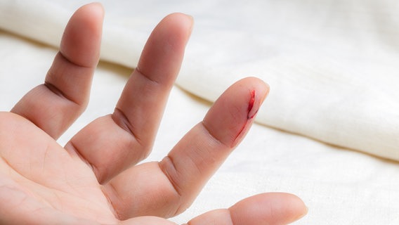 Eine Hand mit einem blutenden Schnitt am Ringfinger. © Colourbox Foto: -