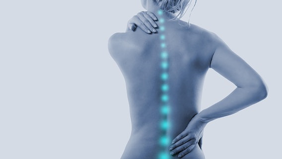 Eine Frau greift sich an Nacken und am Rücken, ihre Wirbelsäule wird als blaue Linie angedeutet, um auf einen Schmerz hinzuweisen. © fotolia Foto: drubig-photo